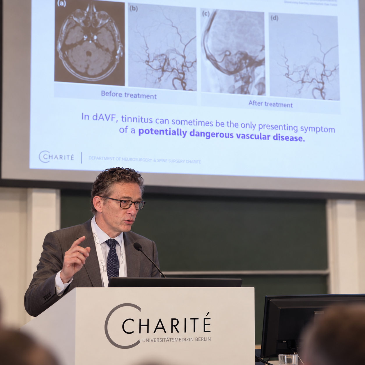 Leading Charité Berlin Neurosurgeon Professor Peter Vajkoczy Highlights Treatable Causes of Tinnitus